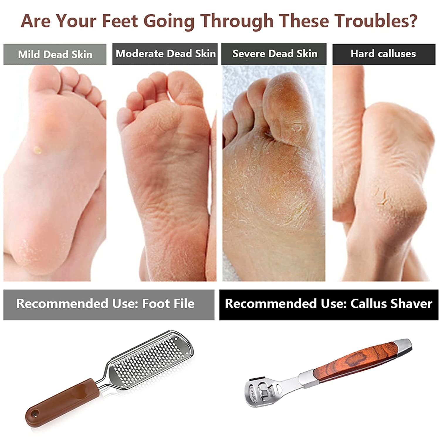 Colossal Foot Rasp & Wood Handle Callus Shaver (10 Replacement & 1 Foot File Heads), Pedicure Foot File Kit, Heel Scraper for Feet, Foot File Callus Remover